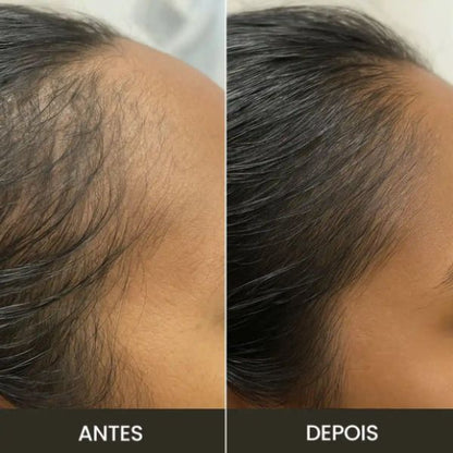 Escova Terapia capilar VittaScalp 4 Em 1