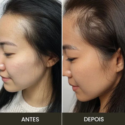 Escova Terapia capilar VittaScalp 4 Em 1