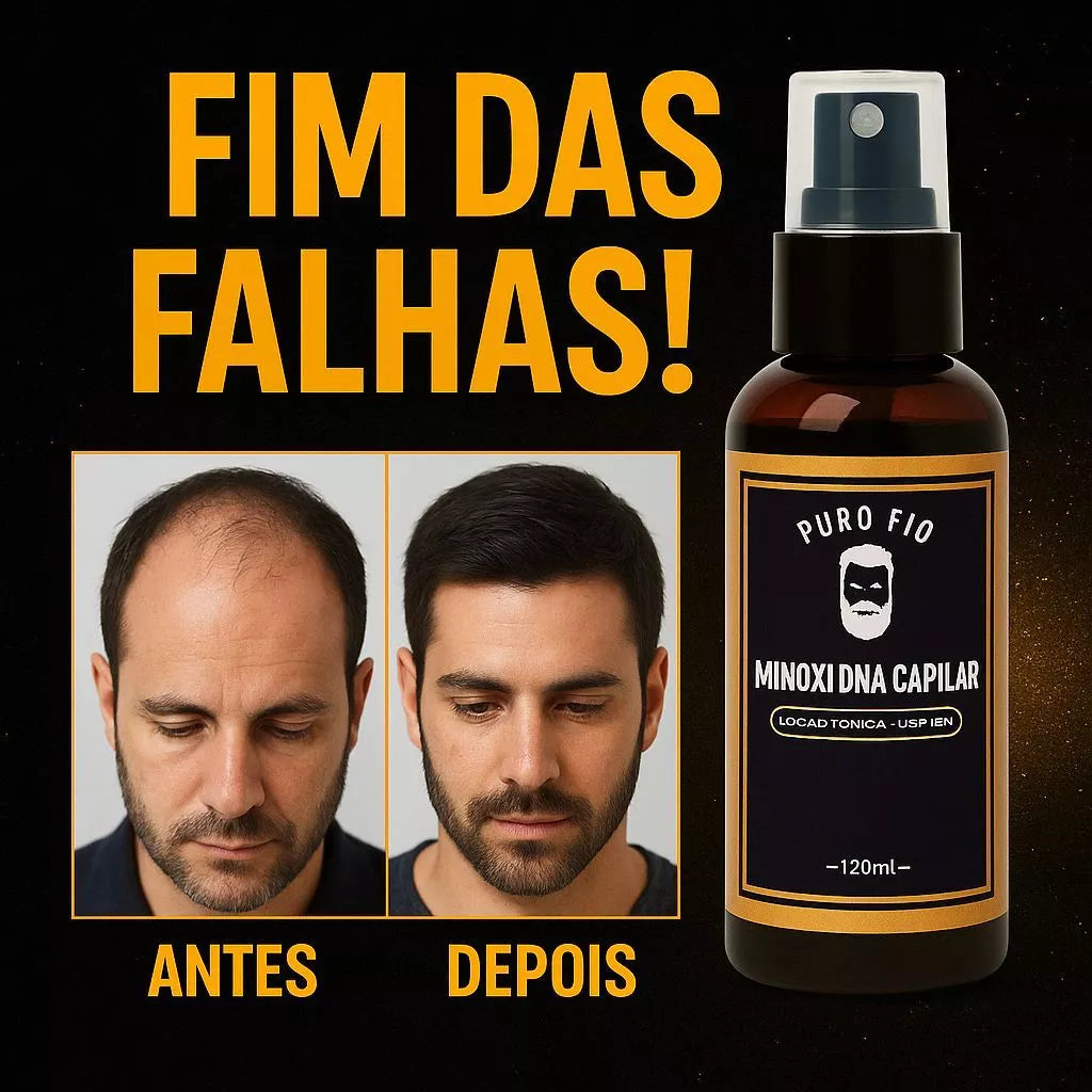 KIT 5X Pro Barber MinoxDNACapilar Spray 120ML Anti Queda Crescimento Barba Cabelo Sobrancelha Bigode 💪 Estimule o Crescimento Natural dos Fios
