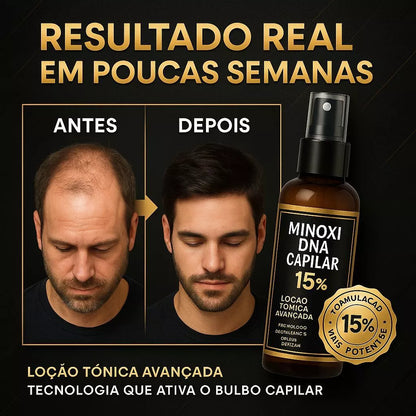 KIT 5X Pro Barber MinoxDNACapilar Spray 120ML Anti Queda Crescimento Barba Cabelo Sobrancelha Bigode 💪 Estimule o Crescimento Natural dos Fios